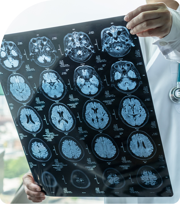  A doctor holding and reviewing a medical scan